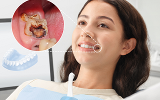 Orthodontic Problems Beyond Crooked Teeth: What You Need to Know