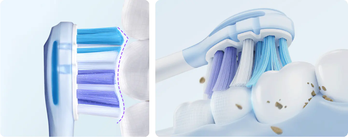 How Often Should You Change Your Electric Toothbrush Head? - usmile