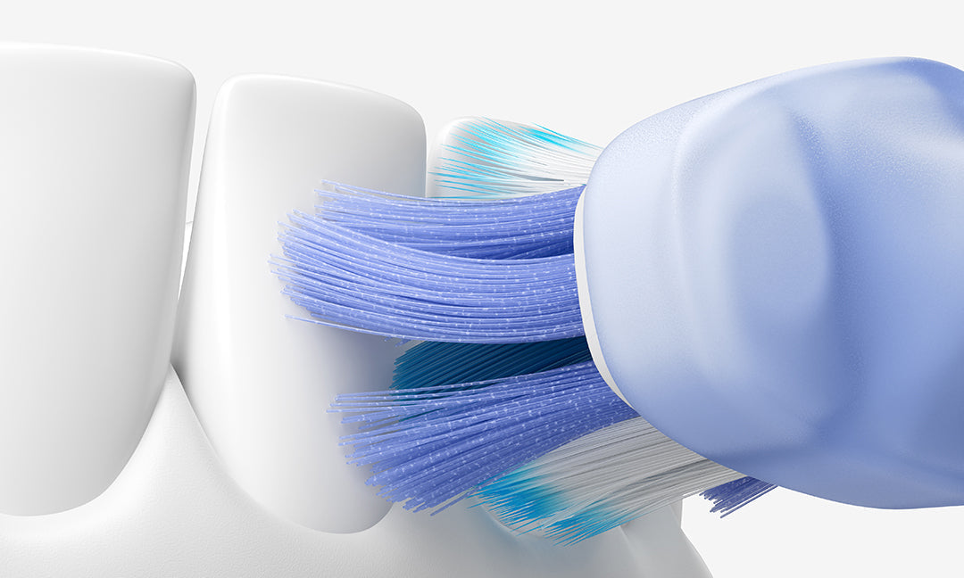 Sonic vs. Electric Toothbrush: Which One Is Better for Your Oral Health?