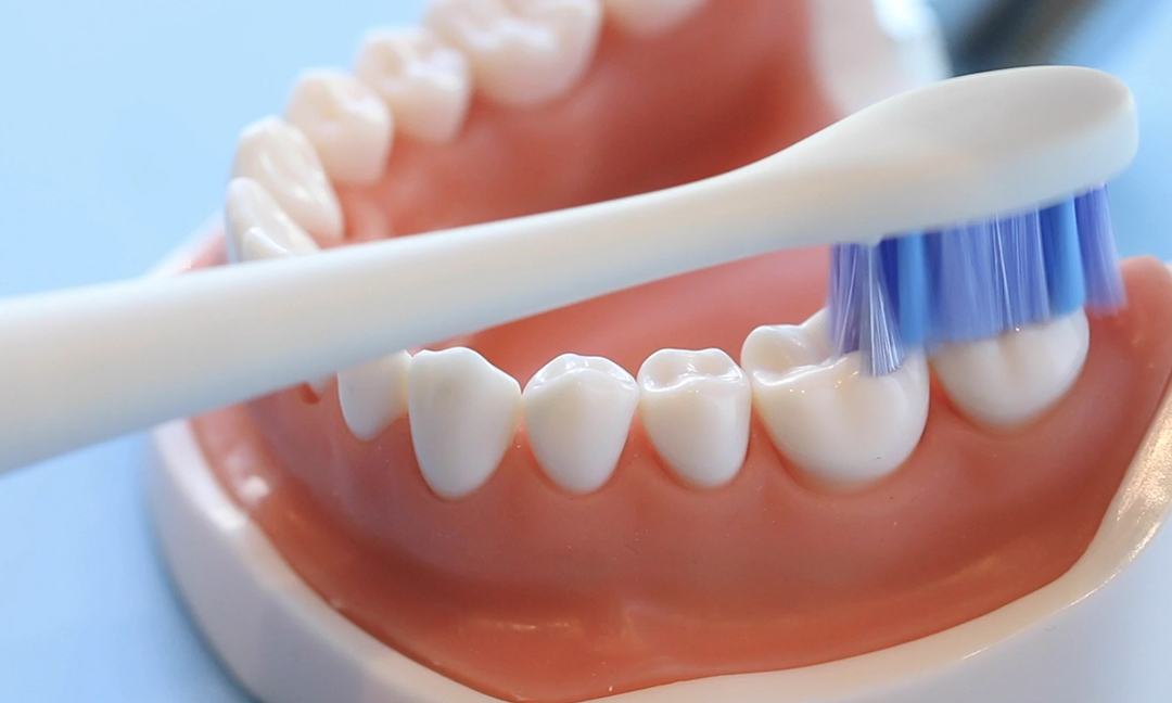 Toothbrush bristles cleaning teeth along the gumline on a dental model