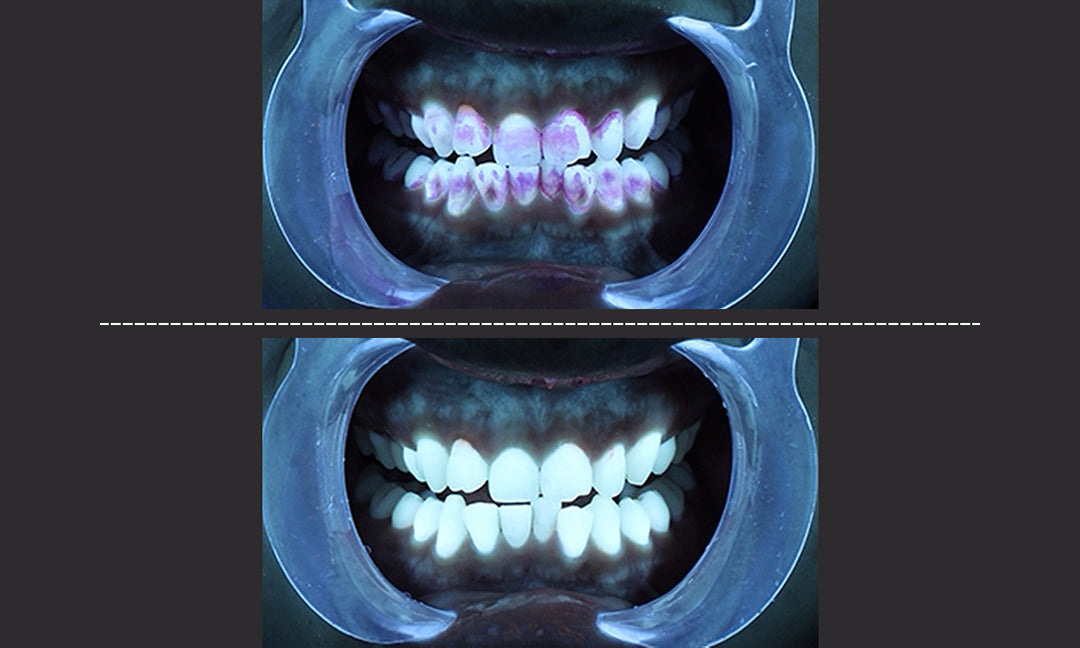 How to Maintain Oral Hygiene: 7 Smart Dentist Tips for a Healthy Smile
