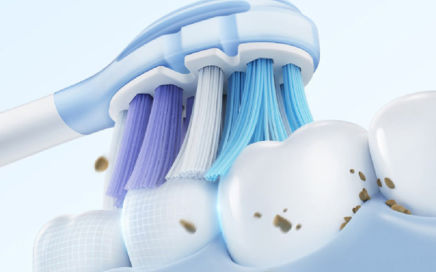 White Stains On Teeth: How To Get Rid Of Them?