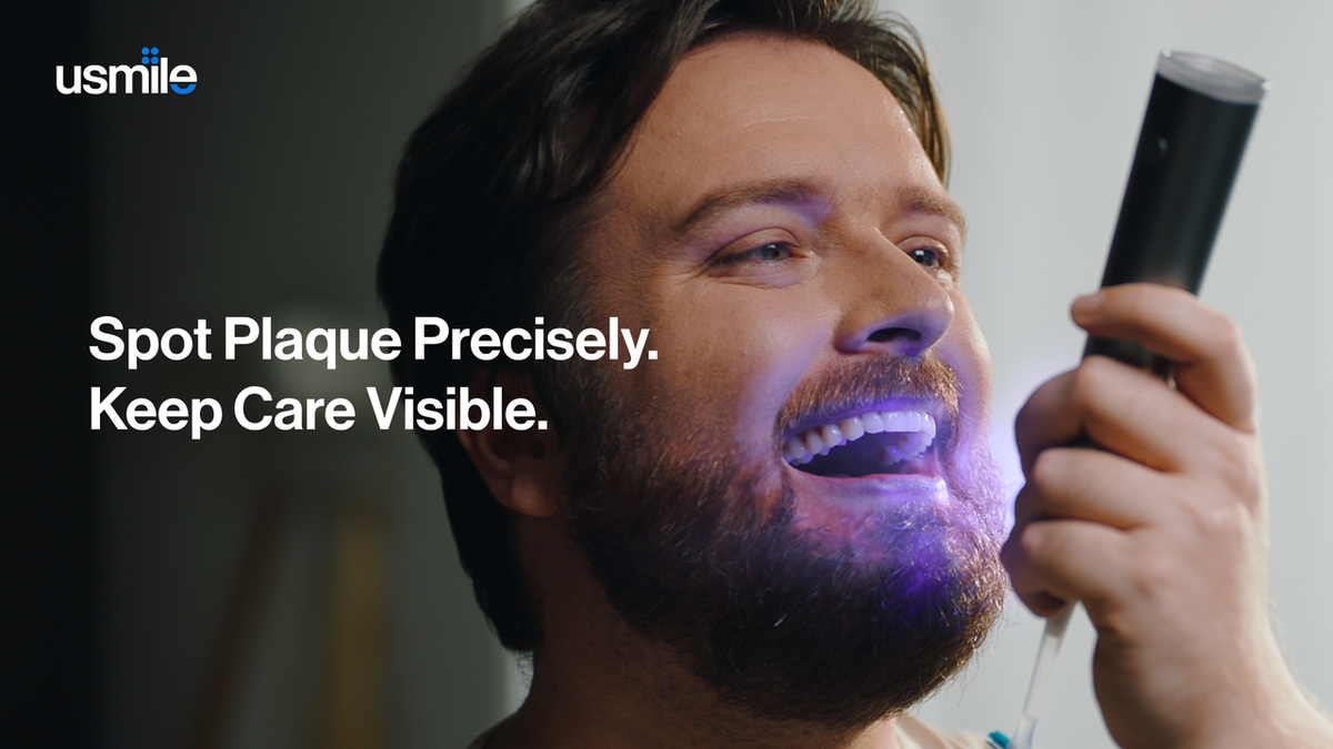 Behind usmile D50 OralCam Toothbrush: From Motion Tracking to Visual Intelligence in Oral Care
