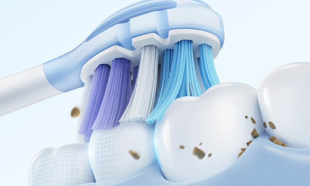 Ultrasonic Toothbrush vs Electric: Which Technology Wins for Your Smile?