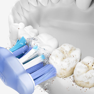 How to Use an Electric Toothbrush: A Step-by-Step Guide