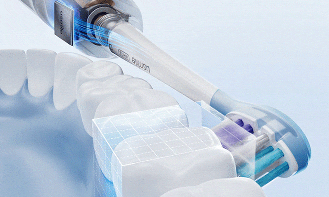 Electric Toothbrush for Sensitive Teeth: How to Choose One Safely