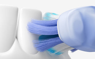 Sonic vs. Electric Toothbrush: Which One Is Better for Your Oral Health?