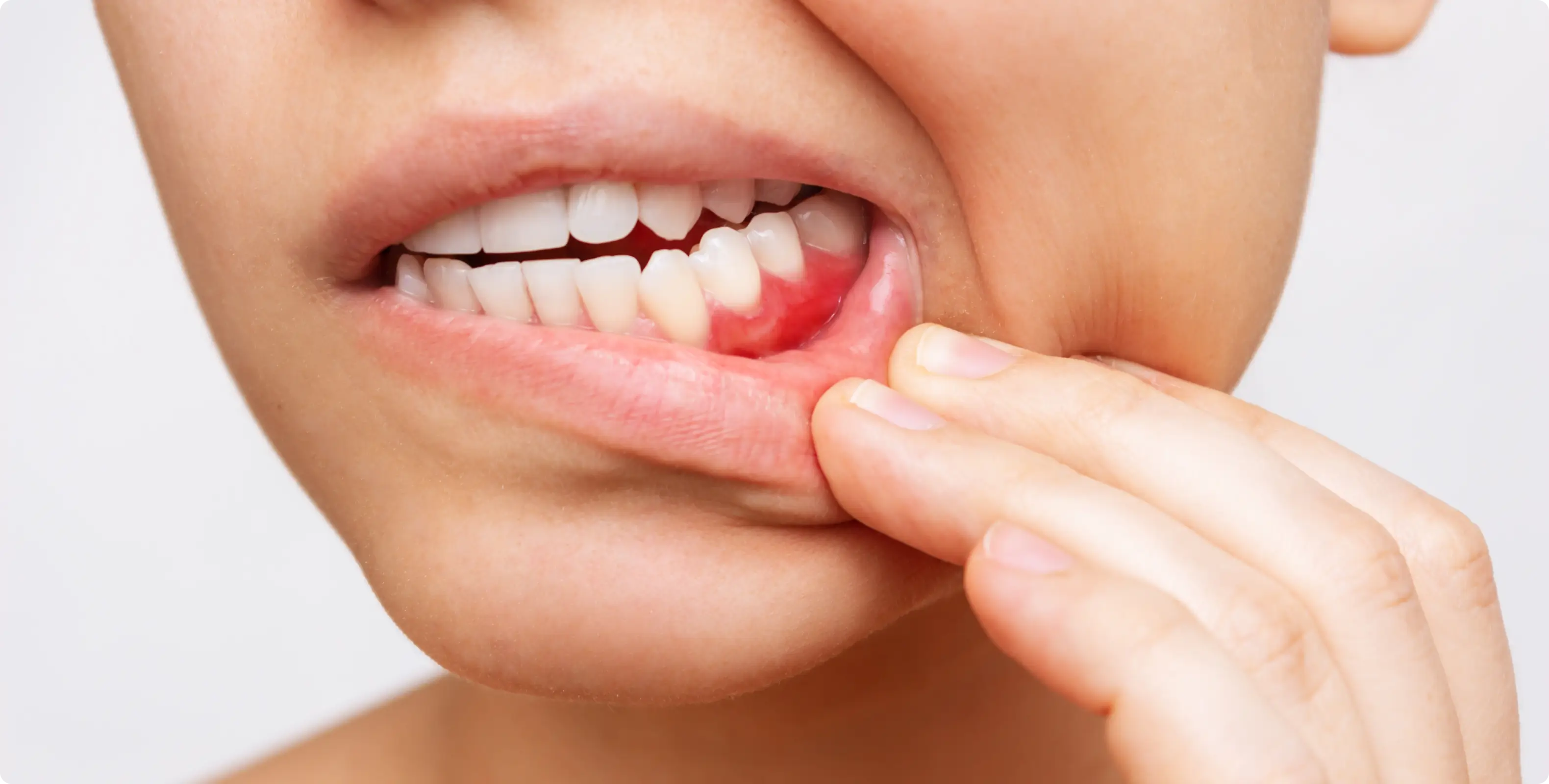 How long until a tooth infection kills you?