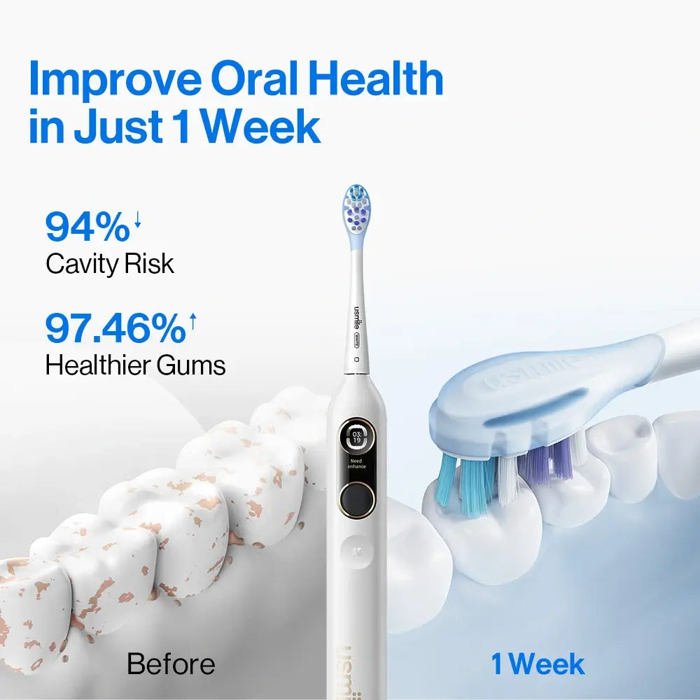 usmile Y10 PRO Electric Toothbrush with Missed Spots Guidance  - Bundle