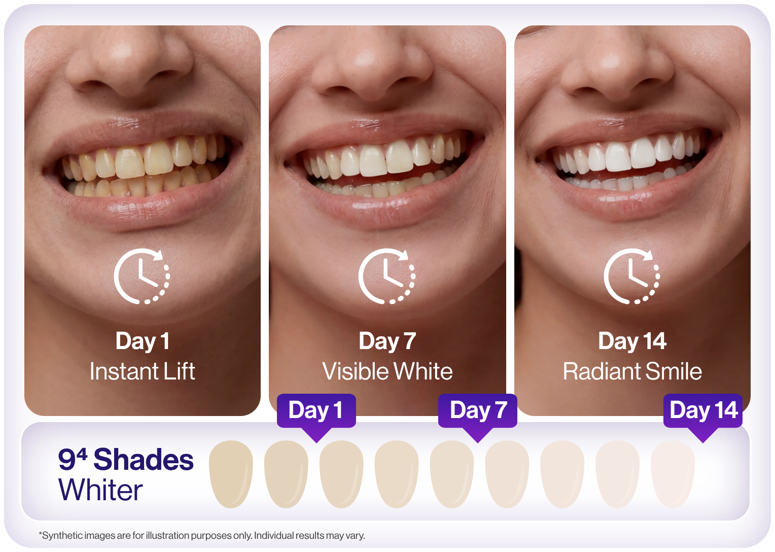A Brighter Smile in 14 Days